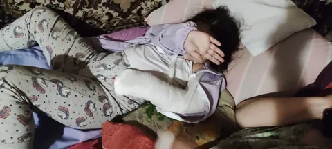 My daughter lying on a bed after breaking her arm, a hand over her face.